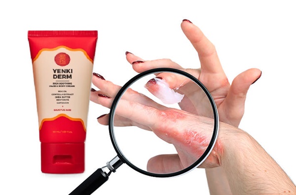 Yenki Derm crema Opinii, Pret România